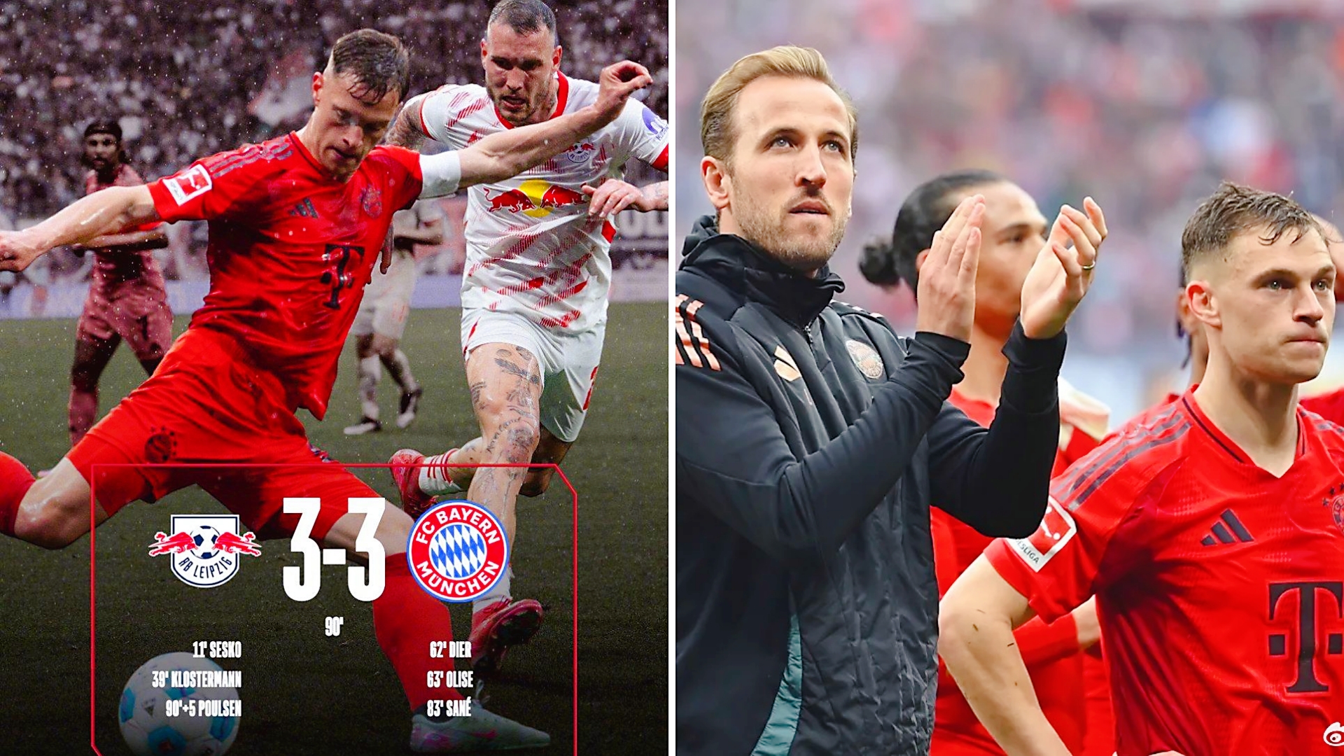 包含拜仁慕尼黑队迎战不莱梅,谁能笑到最后的词条 包含拜仁慕尼黑队迎战不莱梅,谁能笑到最后的词条